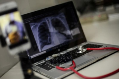 Governo Federal entrega 3 mil kits de telessaúde e lança edital para expandir atendimento a distância com hospitais privados